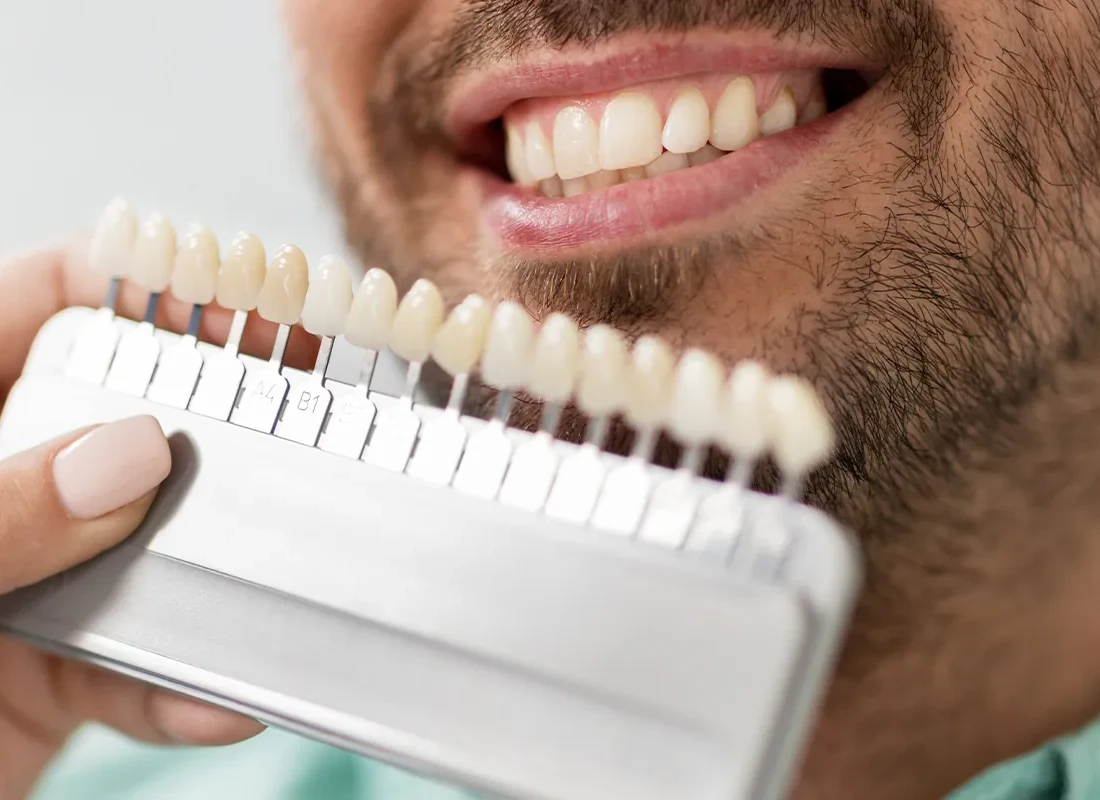 Teeth Whitening in Fullerton, CA