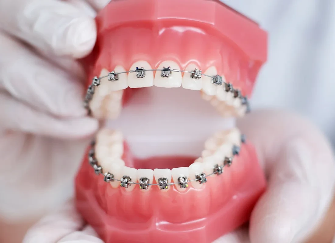 What is orthodontics