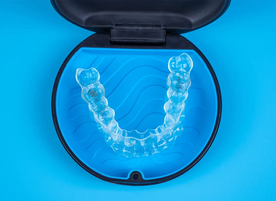 What is Clear Aligners