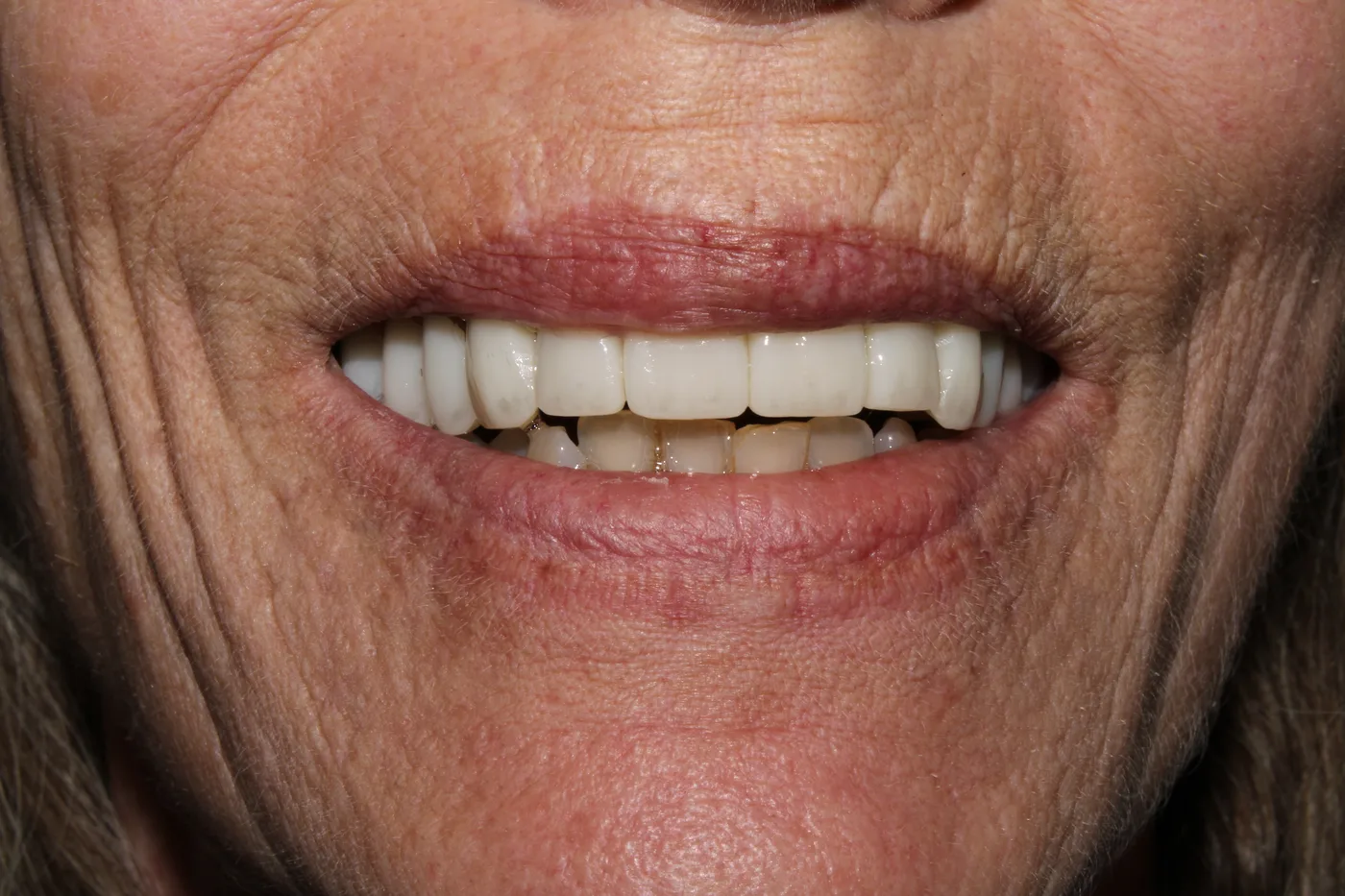 After — Cosmetic dentistry
