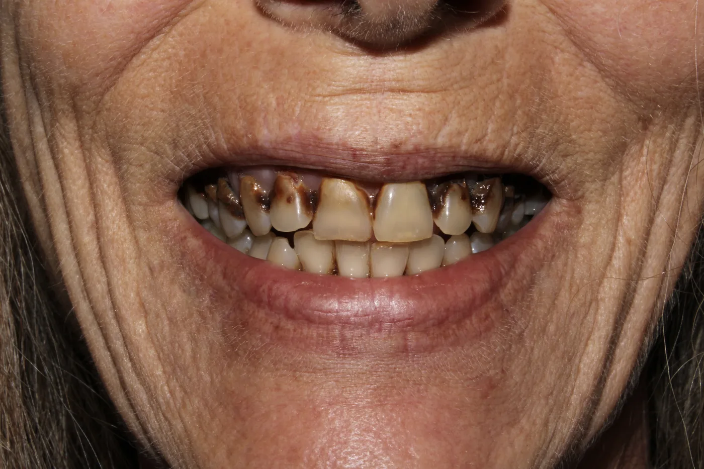 Before — Cosmetic dentistry