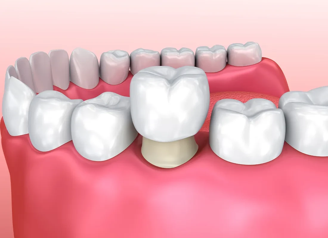 What is restorative dentistry