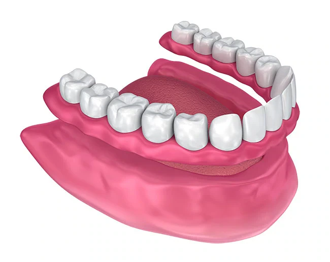 Full Dentures (“Plates”)
