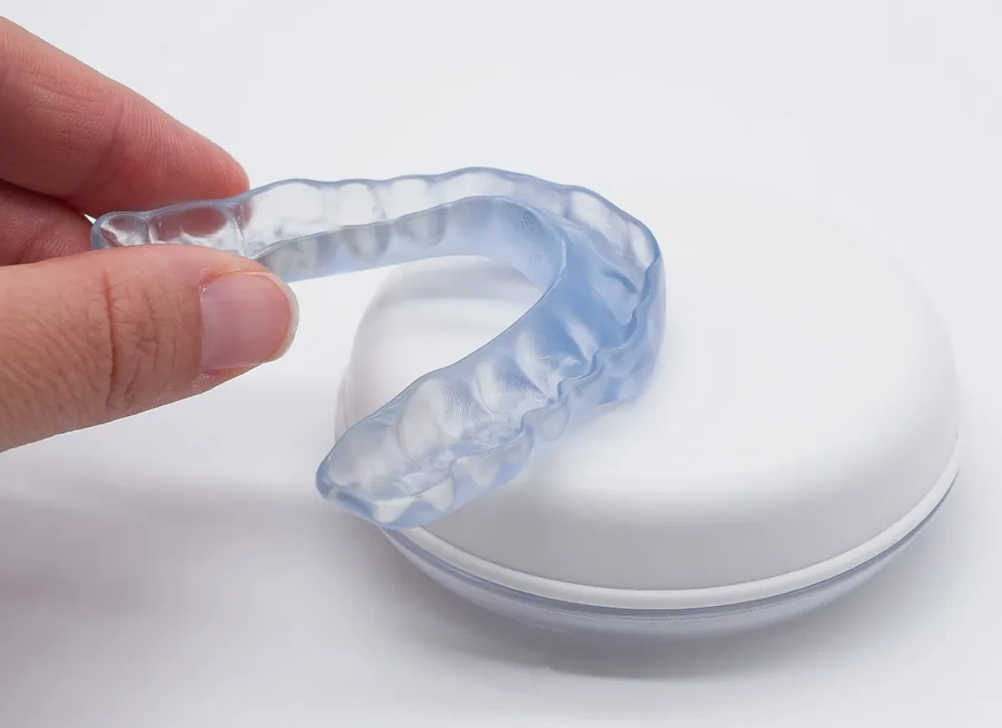 What is Mouthguards