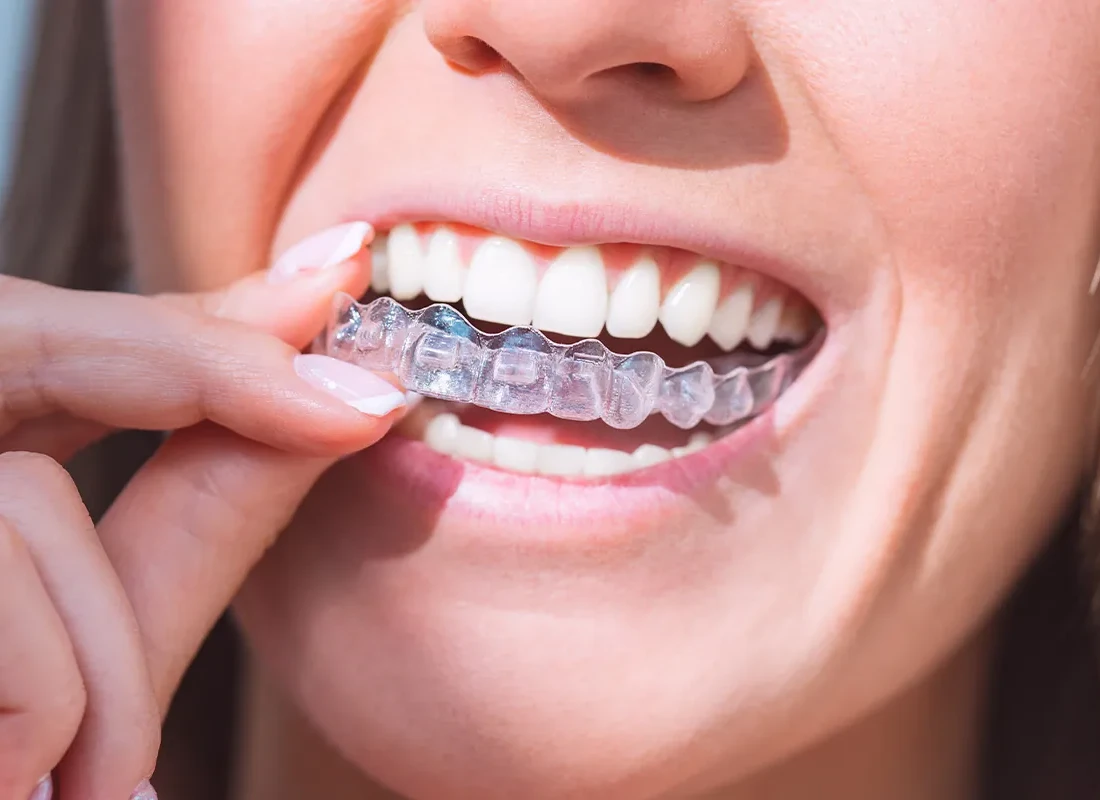 Will a Night Guard Stop Teeth Grinding? Here's What to Know