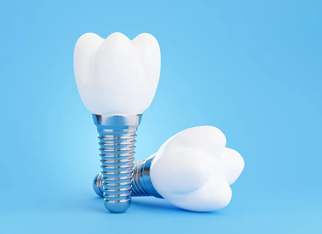 What is Single-Tooth Implant