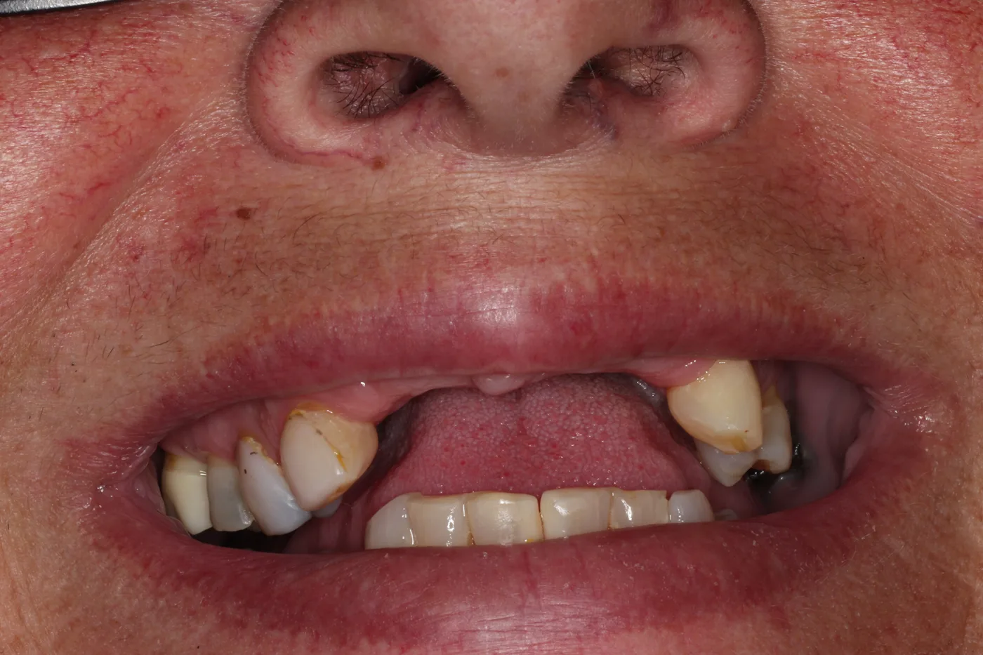 Before — Smile makeover